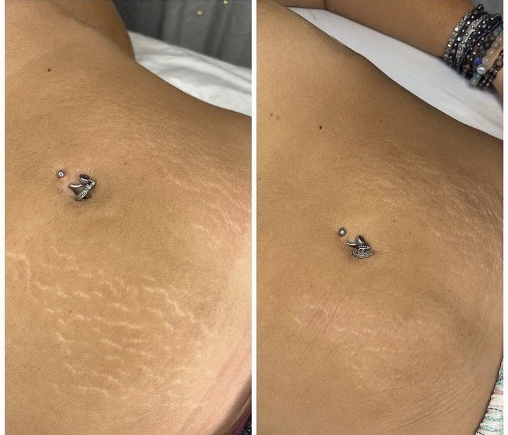 ConniePRINCIPA2's tweet photo. New Upgraded MD Procell Therapies services offered for hair restoration, stretch marks, wrinkles, pigmentation, acne scaring, surgical incision scar reduction and more. https://t.co/el8nZpoEgL https://t.co/LAe1jAh6TI