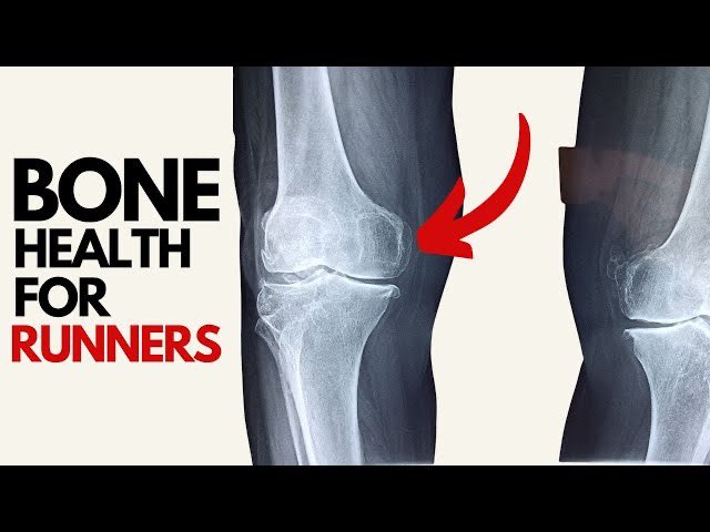 DoctorsRunning's tweet photo. This week’s convo on bone health with Rich Willy, DPT is on YouTube now. Catch this info-packed episode here: https://t.co/acoETmbiKf https://t.co/3H4A045kyo
