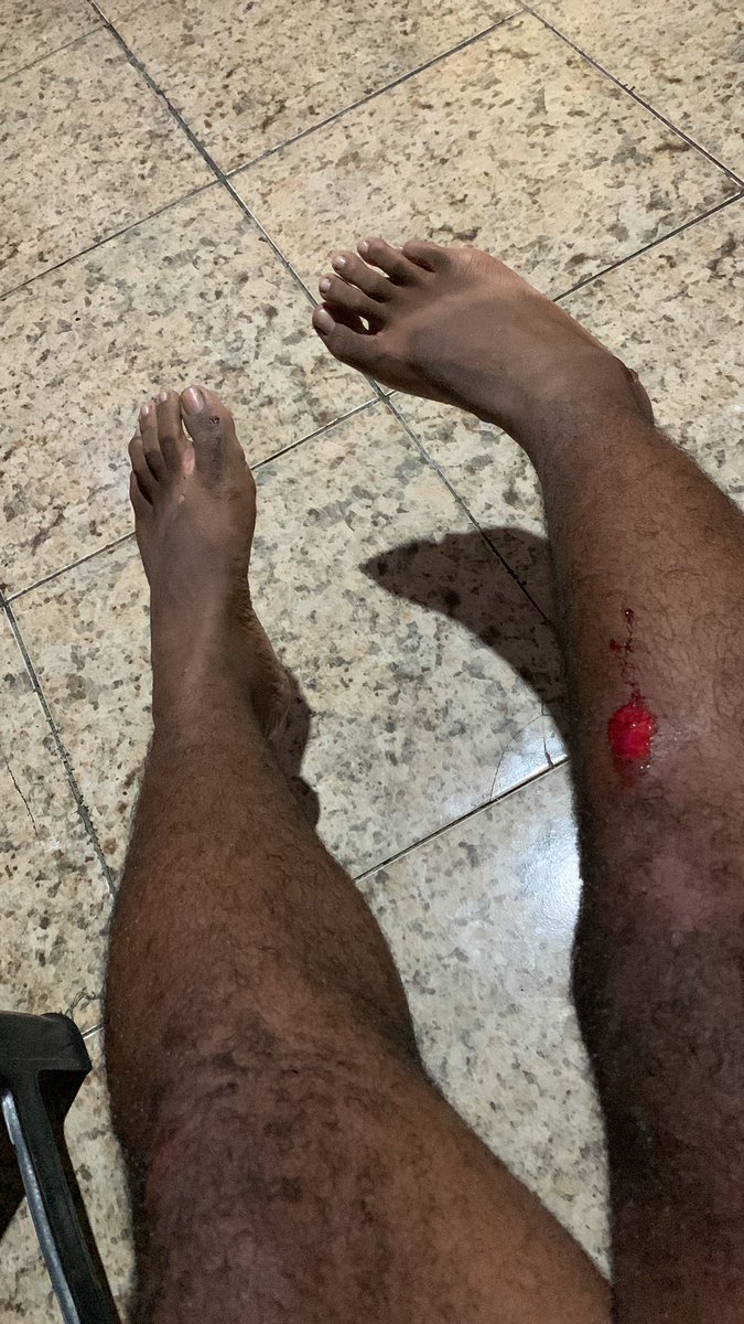 Jeftedasilva22's tweet photo. Varios dia de trabalho vários horas em pé cortando cabelo  6 anos pra comprar minha moto 3 minutos de covardia tiraram minha motinha de mim Chateado 😔💔 https://t.co/YMpKfmoqkD