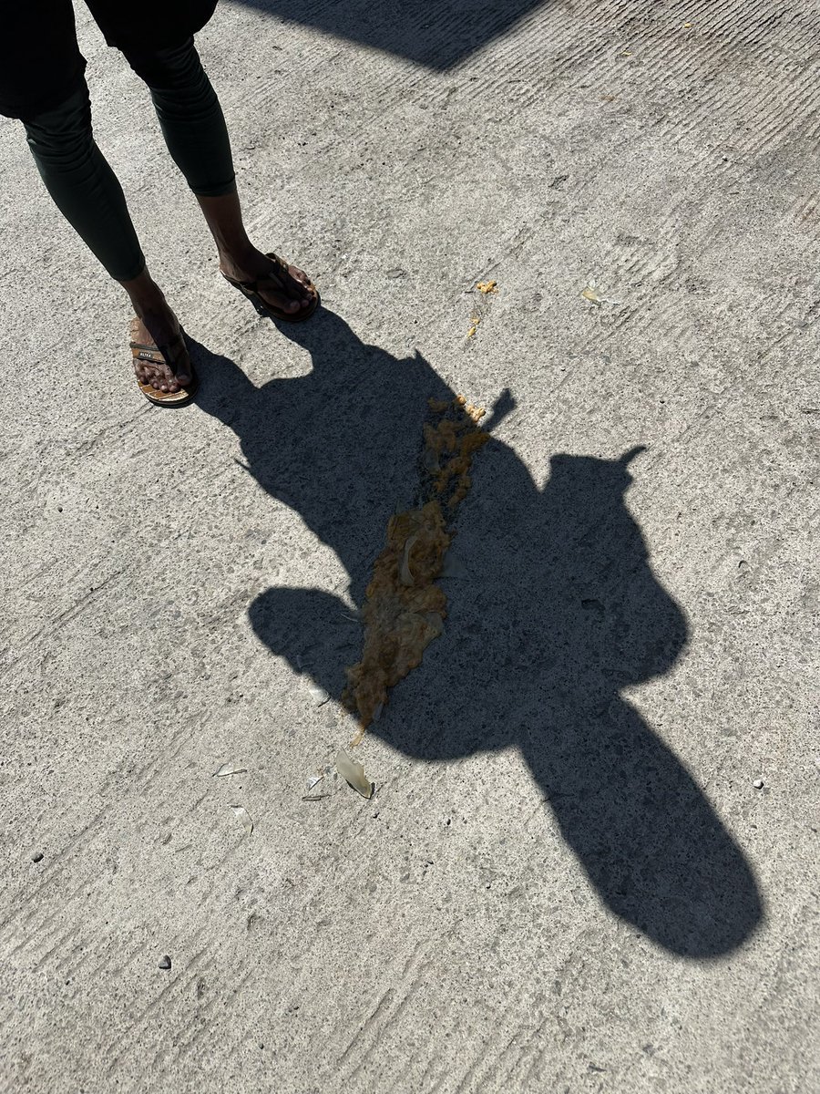 limmmmmy8's tweet image. #보홀 #솔레어리조트 #성게 #망했다
솔레어 앞 해변에 저렇게 직접 잡은 성게를 까고 있다. 흡사 제주도와 비슷하지만 가격은 역시 필리핀이다. 이상한(비위생적)인 병에 가득담아 150페소란다. 샀지..바로 깨트렸지...배탈 안날운명이였던것인가ㅋㅋ병의 위생이 극도로 안좋았지만 맛보고싶었다😭