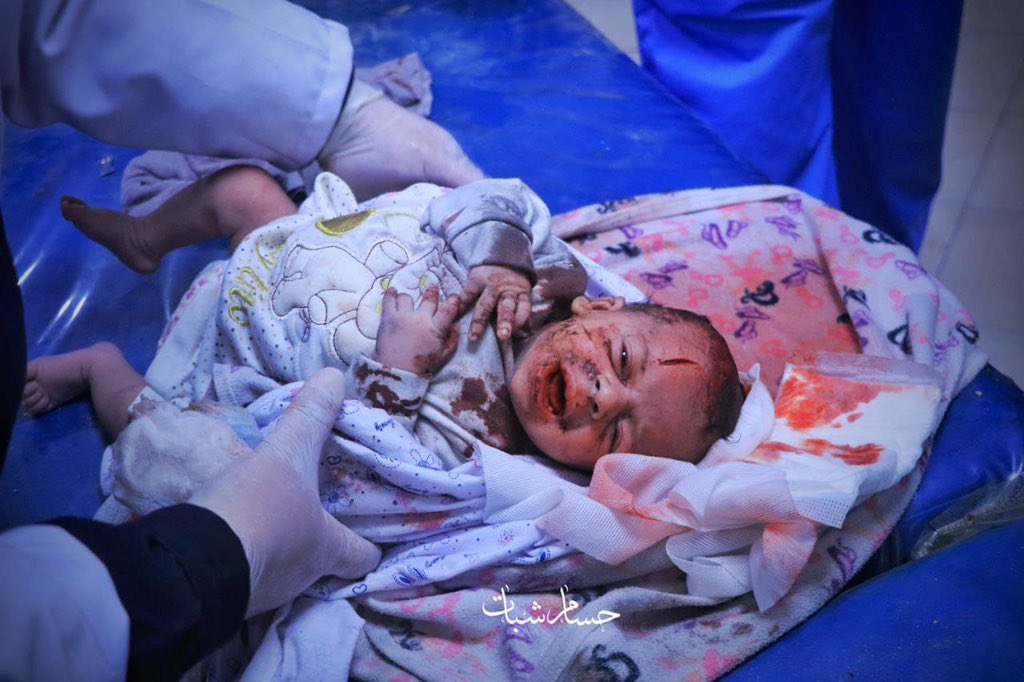 Timesofgaza's tweet photo. lsrael is slaughtering innocent children in Gaza. https://t.co/e11vUwiWJk