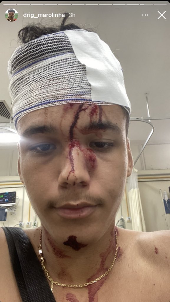 l3nno_'s tweet photo. 🚨URGENTE: Drig marolinha que na última noite foi no show da Carga Nova Ent. 
No começo da festa pediu pra tirar uma foto com Yung Vegan e o rapper atendeu o seu pedido, porém o rapper pediu pra Drig não postar essa tal foto.
Ele postou a foto no seu Twitter e levou um pau.😒 https://t.co/KOpbYBjShC