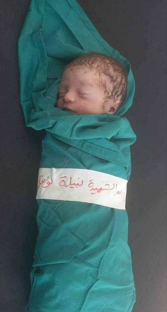 Yassen El Gazzar🔻 🇵🇸🔻 tweet media