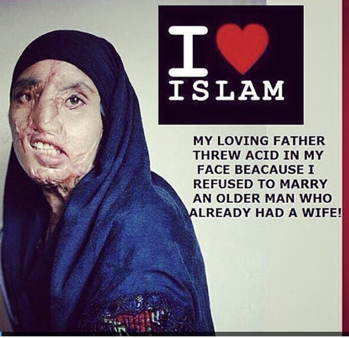“Mi amado padre arrojo ácido en mi cara porque rechacé casarme con un anciano que estaba casado”
Esto es el Islam…
Estos son los que apoyan los socios preferentes del gobierno de España !