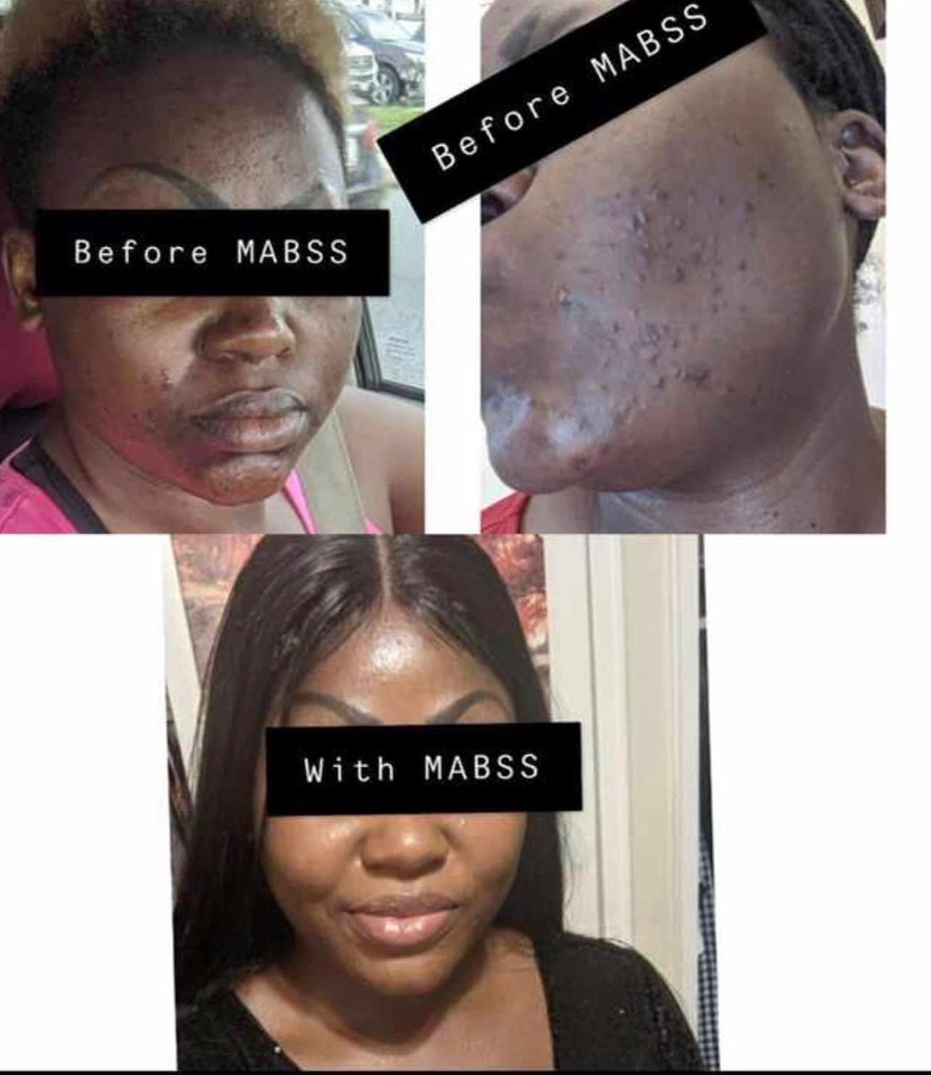 MABSS18's tweet photo. Mass Skincare products are not just for ladies but men too.
Men, take good care of your skin.
For consultation, WhatsApp Mabss:👉🏾 +1 (415) 513-6352
#Mabss #Cameroon #Cameroonians https://t.co/CL98UxMJDK