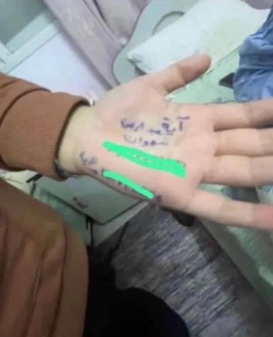 If My Hand survived this my name 

#Gaza 💔
