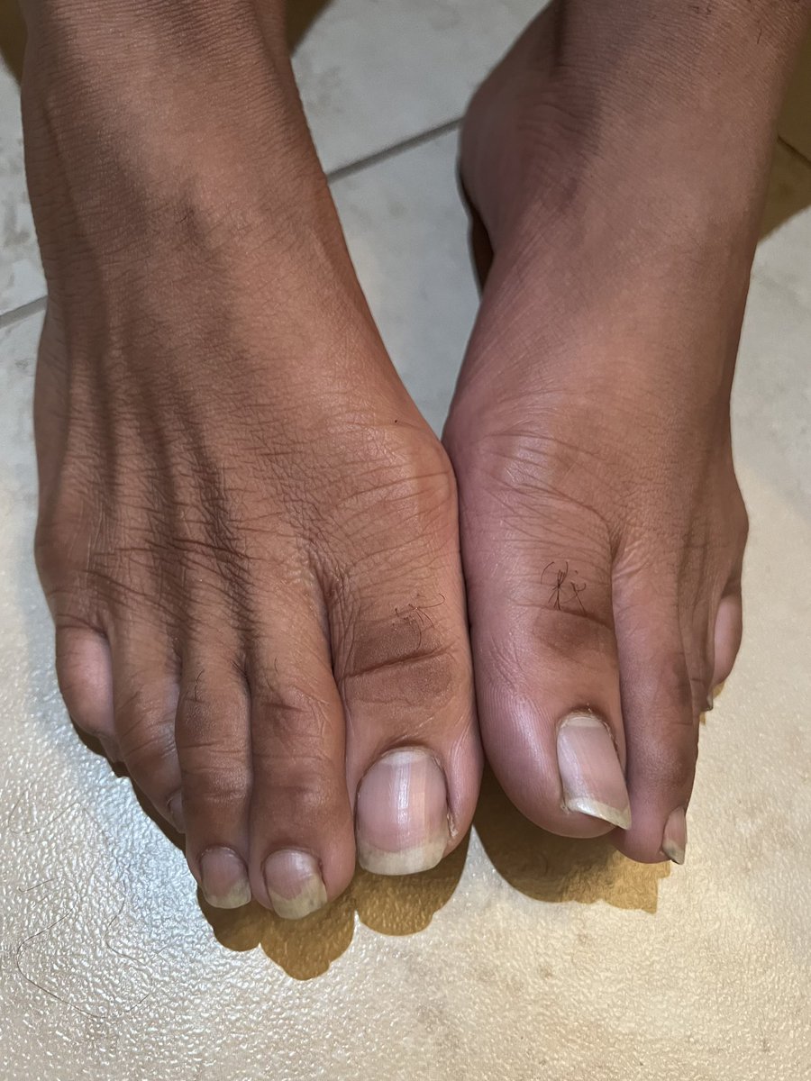 haggle44's tweet photo. Come suck deez toes https://t.co/t1mTlTDd1V