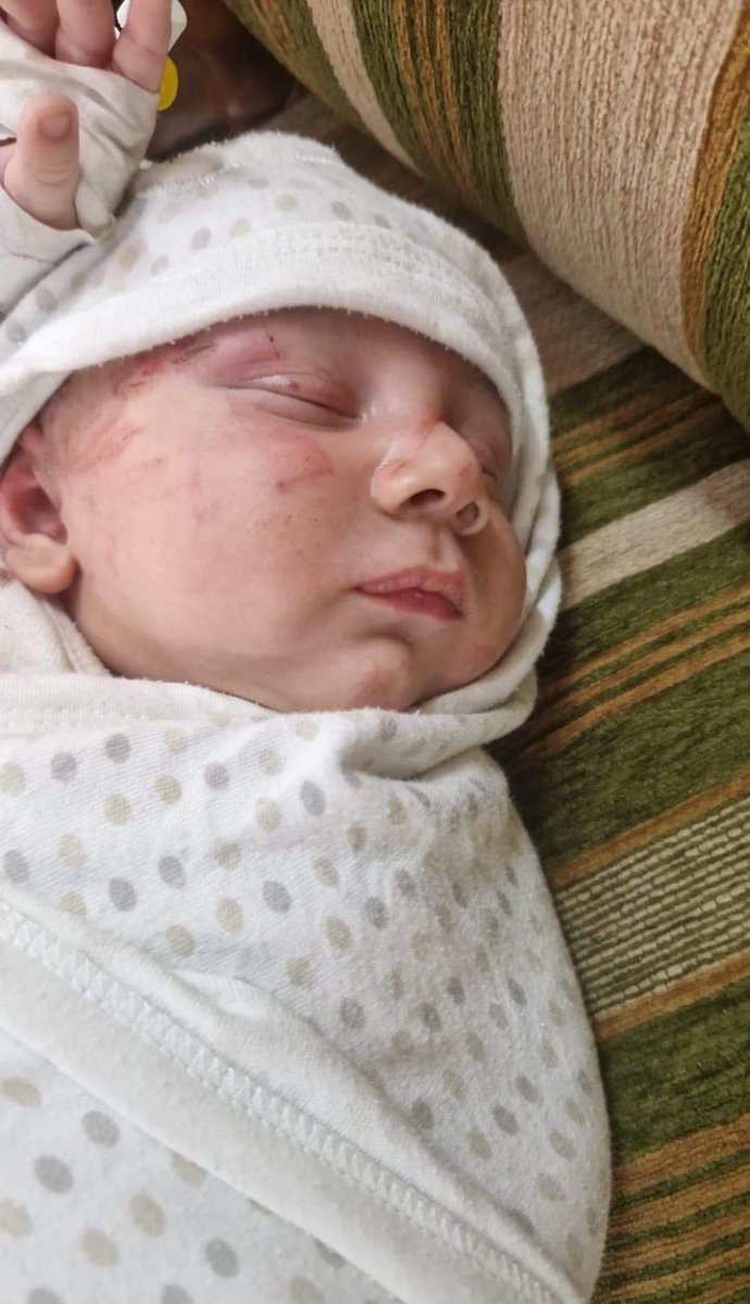 mo7ammedabdalah's tweet photo. اغرب معجزة حصلت معاي ، الطفلة هاي انقصف البيت الي كانت فيه هي واهلها والي هوا بيت جارنا 
بعد ما قصفوا بيتهم رحنا نشوف البيت لقينا البنت هاي طايرة مع الفرشة الي في الصورة على بعد 200 متر من مكان القصف ، والمعجزة الأكبر انه هي الناجي الوحيد من عائلتها الي كانت في البيت . https://t.co/vBqqQGP8yZ