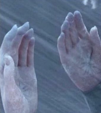 fv2zz's tweet photo. no one:

my hands and feet all the time: https://t.co/8BNIRYUh7B