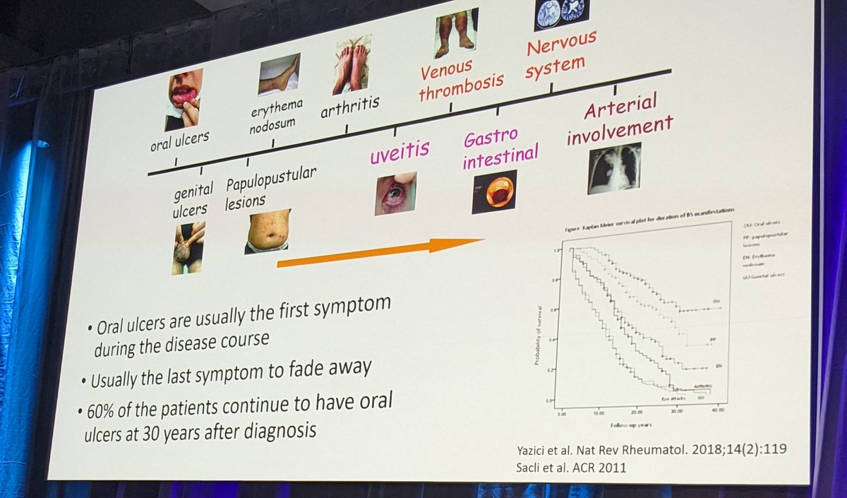 Clinical manifestations of Behçet disease , oral ulcers are usually the first symptom and the last symptom to fade away @eadv #eadvcongress Berlin 2023