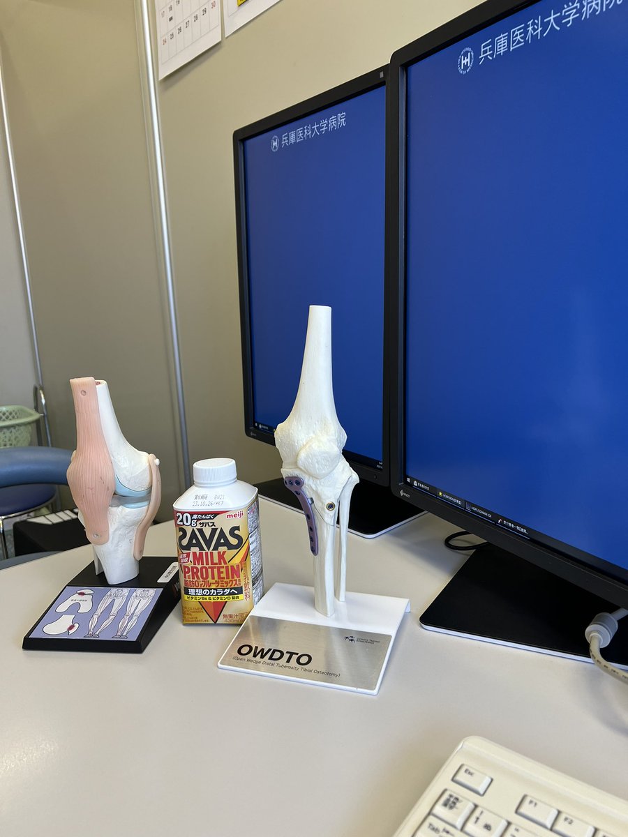 hiroshi0273's tweet photo. 膝スポーツ外来🦵
Outpatient clinic of the knee 🦵
#兵庫医科大学
#西宮回生病院
#大阪回生病院
#整形外科
#変形性膝関節症
#スポーツ復帰
#半月板損傷
#高位脛骨骨切り術
#膝周囲骨切り術
#遠位大腿骨骨切り術
#doublelevelosteotomy
#前十字靭帯損傷
#半月板縫合 https://t.co/E2geKSFNYz