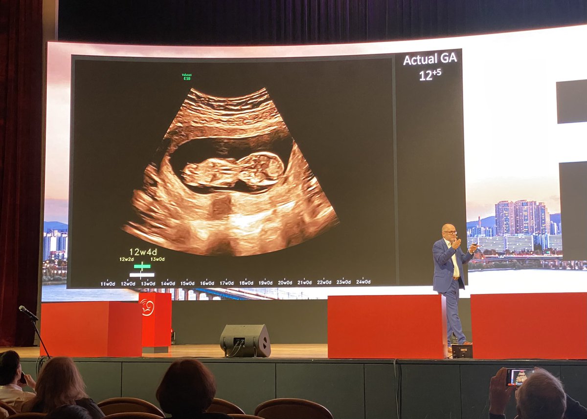 <a href="/FetalUltrasound/">Aris Papageorghiou</a> Prof Papageorghiou Plenary about AI in fetal imaging in the Opening session. Amazing advances of technology with remarkable progress for ultrasound #ISUOG2023
<a href="/ISUOG/">ISUOG</a>