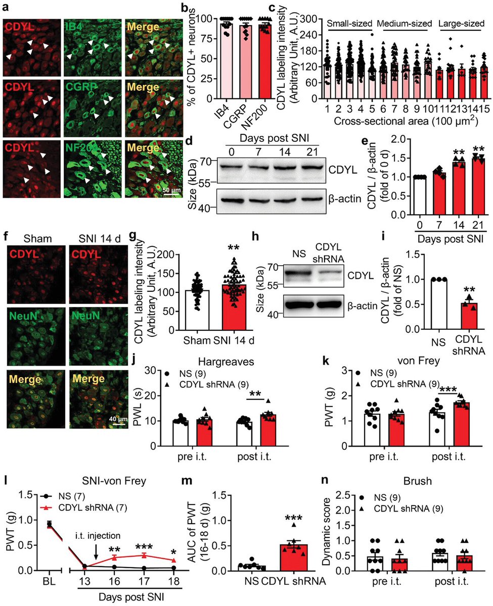 Brain_VTA's tweet photo. Honored to be cited in @AdvancedScnce
https://t.co/NUCjnh1H0I wang’s team found that #CDYL is a critical regulator of pain sensation and #shed light on the development of novel #analgesics targeting #epigenetic mechanisms.
@Brain_VTA offers AAV services
https://t.co/xxPHOIP9Xj https://t.co/KwRhOJdMzH