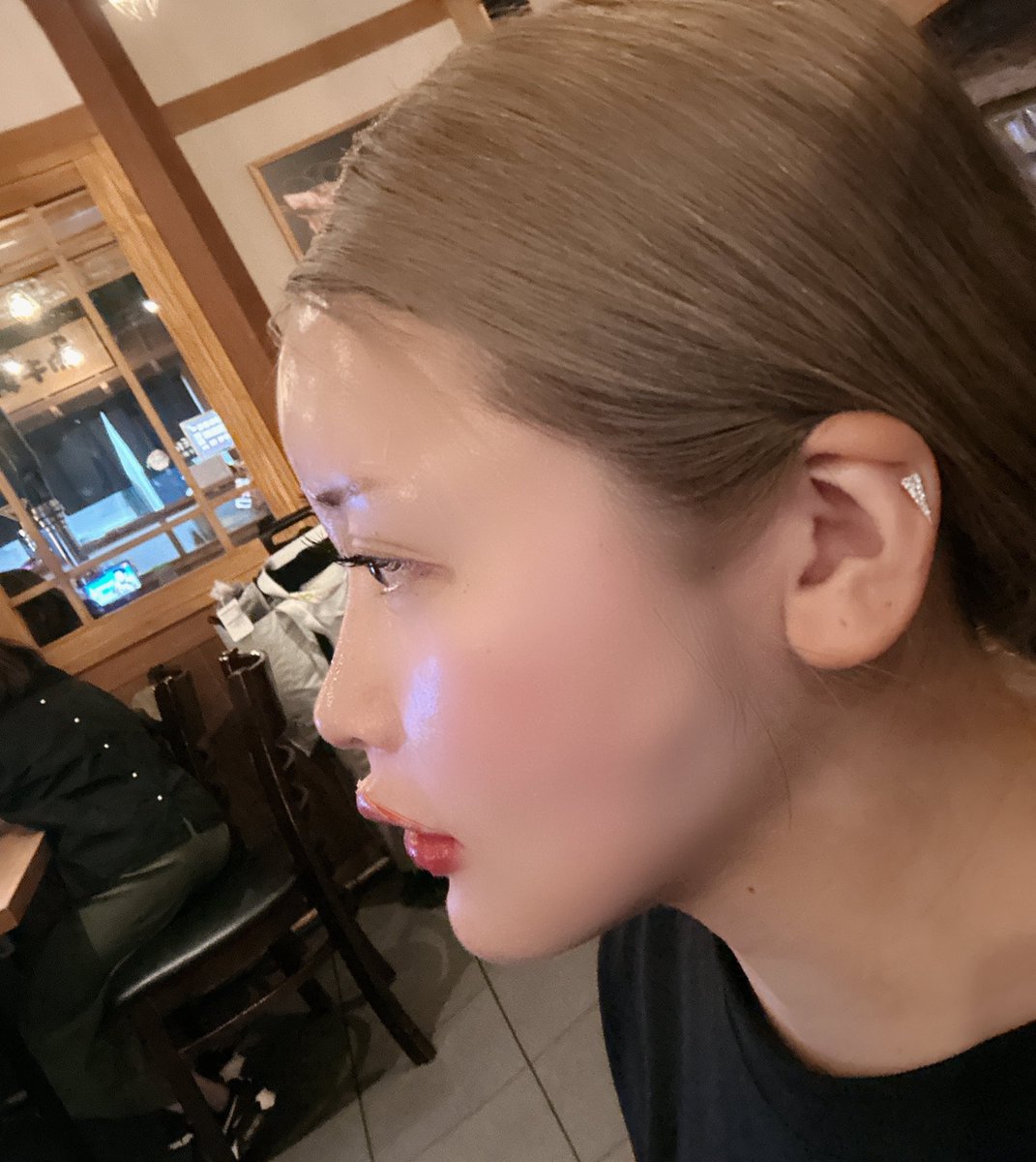 mao126v's tweet photo. まだ完成はしてないけど
横顔が立体的になって幸せ♡

出来れば早くして欲しい🥺
って我儘にも嫌な顔せず対応していただいた…。

初めての韓国、初めてのクリニックだったけど
1人でも全然大丈夫でした☺️🩷

韓国に行く時はまた #byme  でメンテナンスしてもらう🌻

감사합니다🫶🏻

術後30分後と3w後🤍 https://t.co/bTDpejI7d9