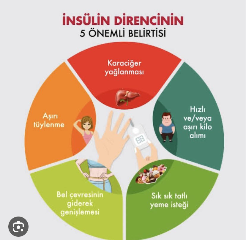 İNSÜLİN DİRENCİNİ NASIL YENERİZ?;
🧚‍♂️Günde 5000 bin adım atacağız
🧚‍♂️Saat 23 de yatmış olacağız
🧚‍♂️Glisemik indeksi düşük besinler tüketeceğiz
🧚‍♂️Tarçın,yeşilçay ve elma sirkesi tüketeceğiz
🧚‍♂️Ayrıca;Krom,myoinositol veya berberin gibi doğal takviyeler insulin direncini dengeleyebilir