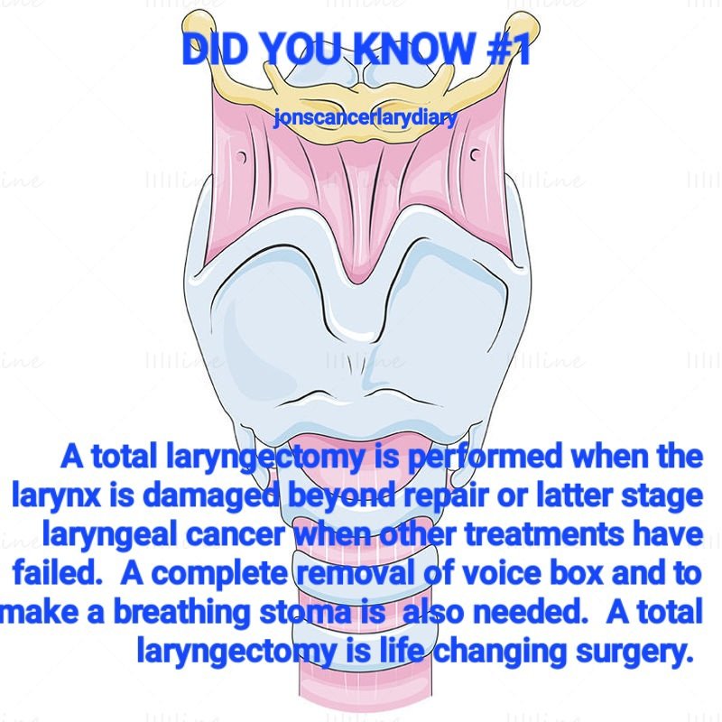 I am starting today for 10 days to help raise awareness about the total laryngectomy and effects on patients. Hopefully, some will find interesting and maybe ask questions.
#laryngealcancerawareness 
#totallaryngectomy #lifeafterlary