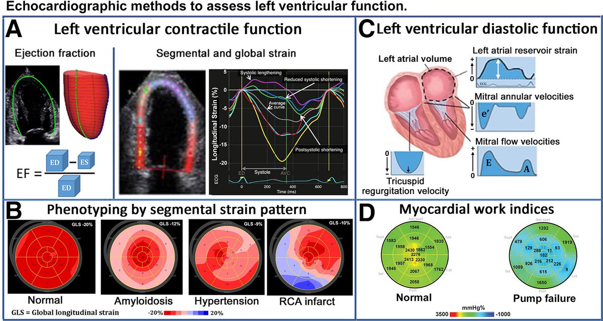 Nice review on Phenotyping heart failure by #Echofirst in @ESC_Journals #EHJIMG Here are the main points to remember: Myocardial strain imaging is complementary to EF and can be used with low EF. GLS is more sensitive than EF to diagnose mild systolic dysfunction. In small,…