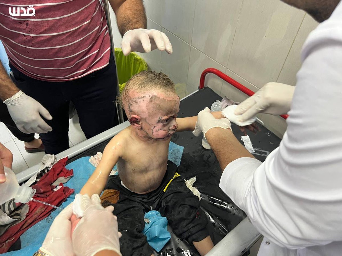 ساعدوا، افعلوا شيئاً، نيابة عن الإنسانية، نيابة عن الأبرياء 📷 ماذا يستحق هؤلاء الأطفال هذا؟