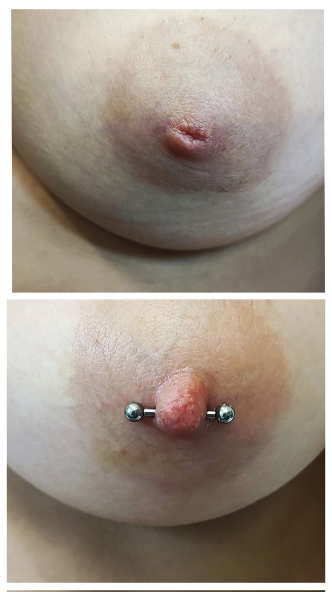 LaylaSnakebite's tweet photo. Nipple piercing su capezzolo introflesso. Eseguito da Holdfast tattoo studio, Finale Ligure. #nipplepiercing #freethenipps #titaniumjewels #piercerlife #piercinglovers https://t.co/usmSjUChZQ