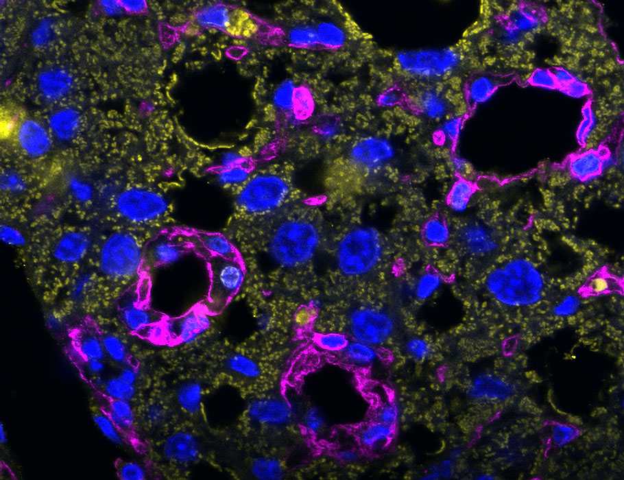 ScienceMagazine's tweet photo. New research in mice reveals one T cell subset behind the progression of metabolic-associated fatty liver disease to non-alcoholic steatohepatitis (NASH)—a widespread and damaging liver condition accompanied by inflammation and fibrosis. https://t.co/dYCiWqttTH @SciImmunology https://t.co/YZr86GO9Ts
