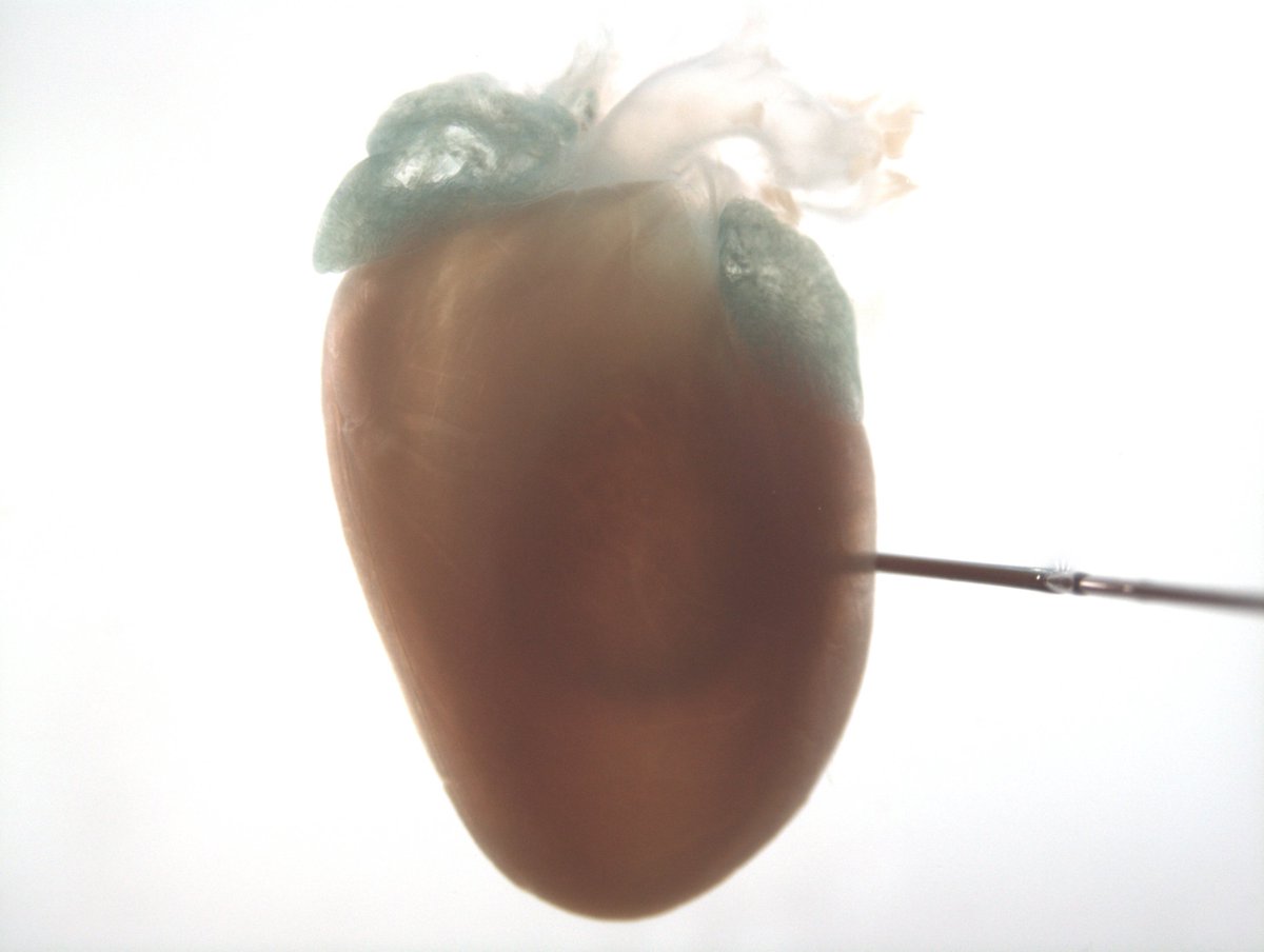 Today's #GeneOfTheDay is #Agl. Human diseases associated include Glycogen Storage Disease Iii. Mice with inactivated Agl exhibit increased heart weight, increased circulating alanine transaminase level and increased lean body mass. More data here: bit.ly/AglGene