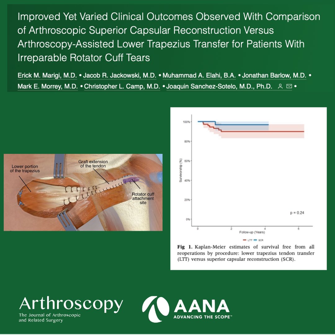 Improved yet Varied Clinical Outcomes Observed with Comparison of Superior Capsular Reconstruction vs Arthroscopic Assisted Lower Trapezius Transfer for Patients with Irreparable Rotator Cuff Tears. ow.ly/NpYp50PWPVM @DmarigsMD @JonBarlowMD @ChrisCampMD @JSanchezSotelo