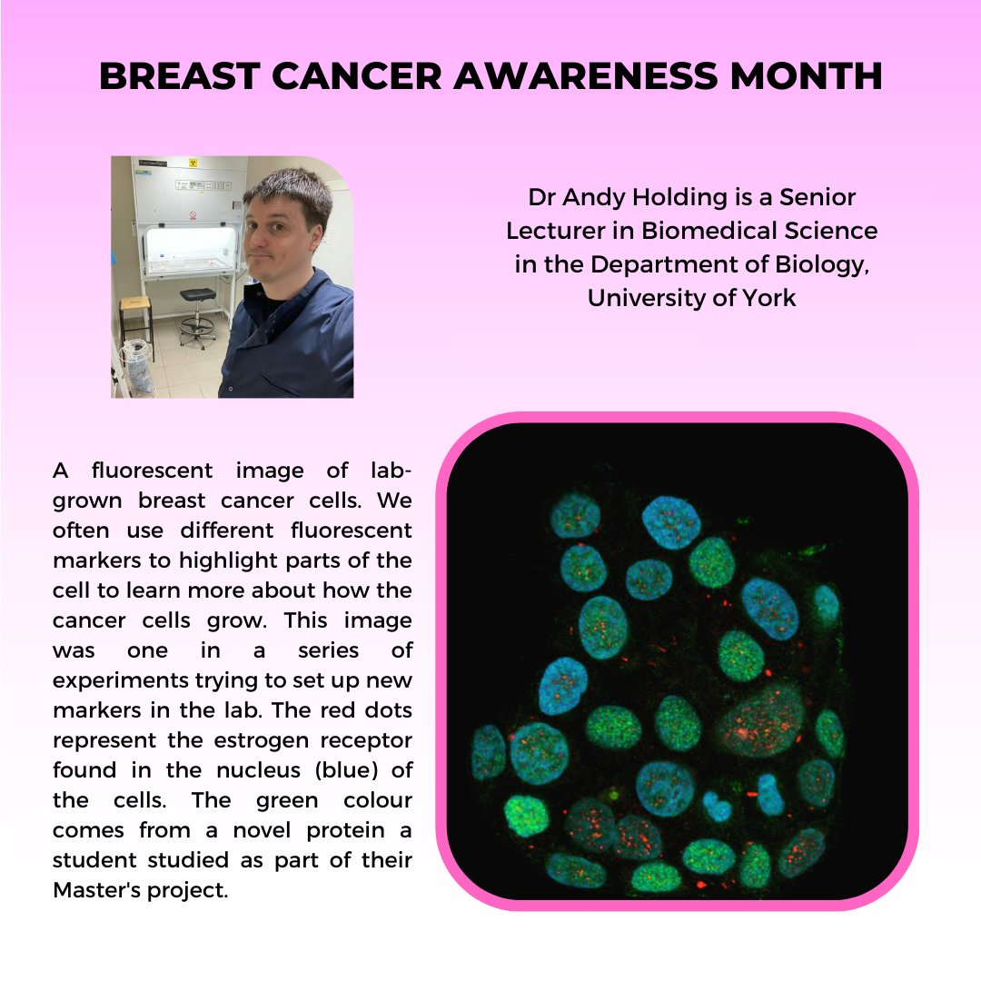 York Biomedical Research Institute (@ybri_uoy) on Twitter photo <a href="/AndrewHolding/">Dr Andrew Holding</a> aims to understand the impact of steroid hormones on cancer patients. This #research is hugely important because steroid hormones are both produced naturally by the body and are an essential medication to treat the symptoms of #cancer #BreastCancerAwarenessMonth <a href="/AndrewHolding/">Dr Andrew Holding</a> aims to understand the impact of steroid hormones on cancer patients. This #research is hugely important because steroid hormones are both produced naturally by the body and are an essential medication to treat the symptoms of #cancer #BreastCancerAwarenessMonth