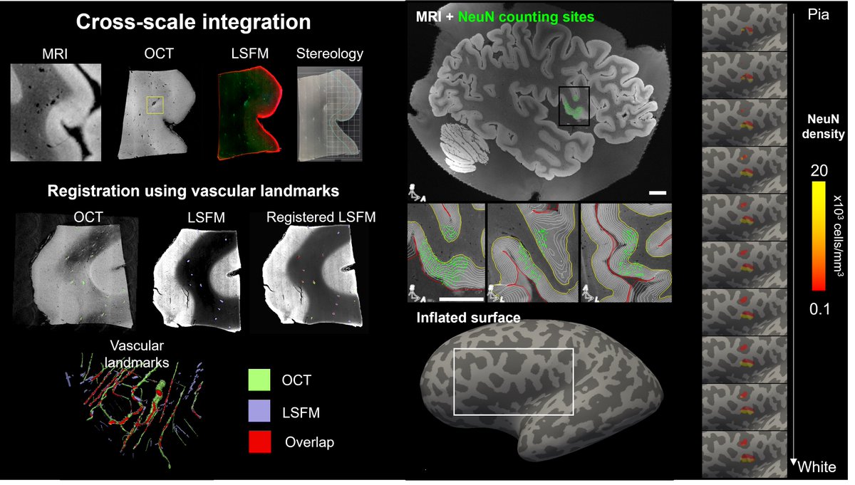 MGHMartinos's tweet photo. In a major advance, Bruce Fischl and colleagues report a comprehensive cellular atlas of Broca’s area. Ultimately, the methods developed for the study could help create 3D models of an entire human brain. https://t.co/fwSUxxfqOt @FreeSurferMRI @MGH_RI @ScienceAdvances https://t.co/5CMJKavRj4