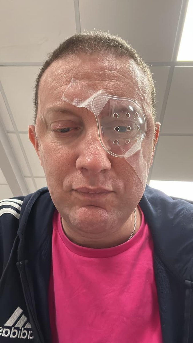 Cataract operation done weirdest feeling ever. Sexy look 👀