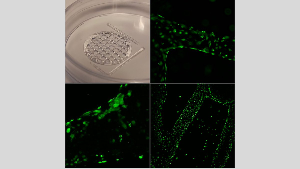 MicroIMIBIC's tweet photo. Optimizing HUVEC cells #bioprinting with different GelMA conditions using REG4Life. @REGEMAT3D @IMIBIC https://t.co/8yaiQZuP38
