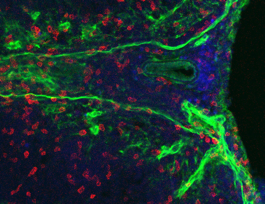 Science Immunology (@sciimmunology) on Twitter photo To help stem the autoimmune progression of #MultipleSclerosis, new research in mouse models of the disease suggests targeting integrin α3, which is selectively expressed by pathogenic Th17 cells. <a href="/MariaCiofani/">Maria Ciofani</a> <a href="/DukeUniversity/">Duke Blue Devils</a>
📄: scim.ag/4tu To help stem the autoimmune progression of #MultipleSclerosis, new research in mouse models of the disease suggests targeting integrin α3, which is selectively expressed by pathogenic Th17 cells. <a href="/MariaCiofani/">Maria Ciofani</a> <a href="/DukeUniversity/">Duke Blue Devils</a>
📄: scim.ag/4tu
