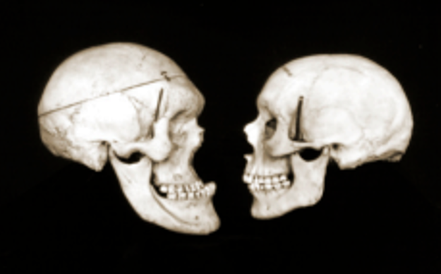 bmoreProjects's tweet photo. Next Up: The Crimes of (#JohnsHopkins neurosurgeon) Harvey Cushing. An expose that must be told by showing the inhumane collection of human remains. 
WARNING #MedicalExperiments #YaleLibrary #UncollectOurAncestors https://t.co/jODI93tjBs