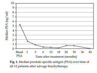 To evaluate toxicity, prostate-specific antigen (PSA) kinetics, and cancer control of high-dose-rate brachytherapy (HDR-BT) as a salvage modality for men with locally recurrent prostate cancer, after primary HDR-BT failure.
termedia.pl/Salvage-brachy…