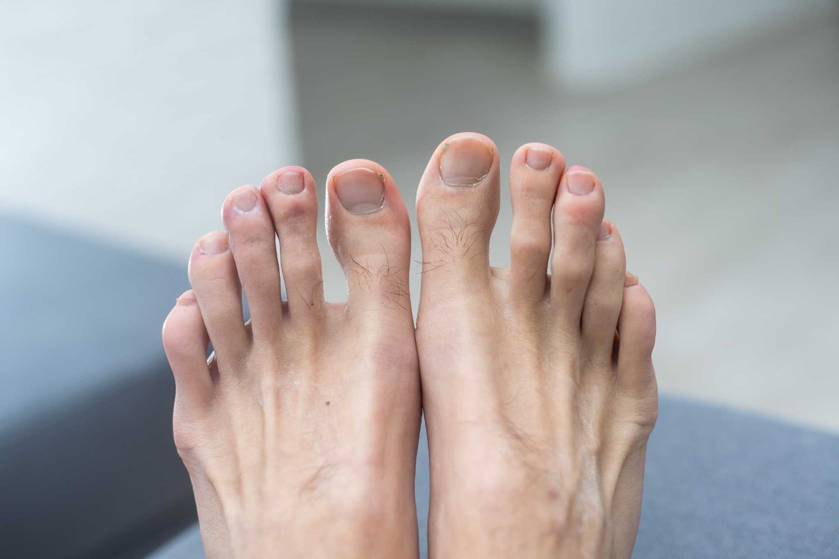 BurlingtonFoot's tweet photo. Ingrown toenails can be more than just a nuisance. Let us help you prevent and manage them for healthier, happier feet. #PodiatryCare #HealthyFeet
https://t.co/Bkun0zyj0g https://t.co/wKwVuZO3Aa