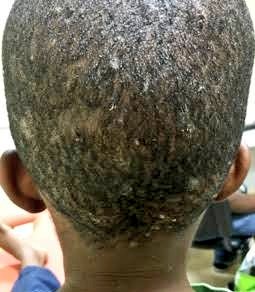 🗿 🅱️éton 2La ®️épublique 🇨🇩 tweet media