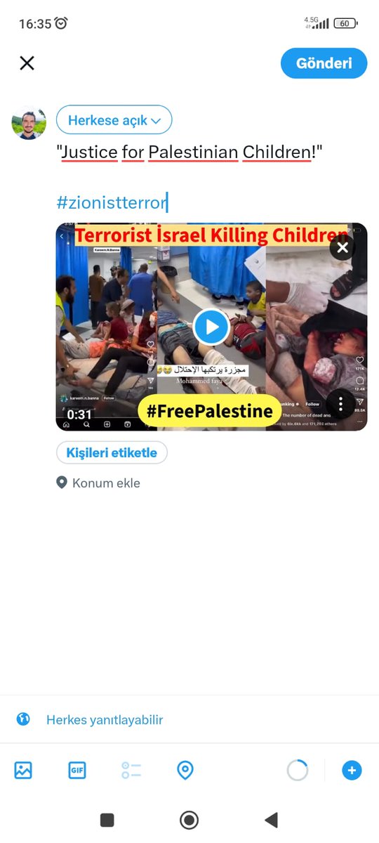 Dünya Gazze'ye sağır kör kesildi 
"Justice for Palestinian Children!" #ZionistTerror