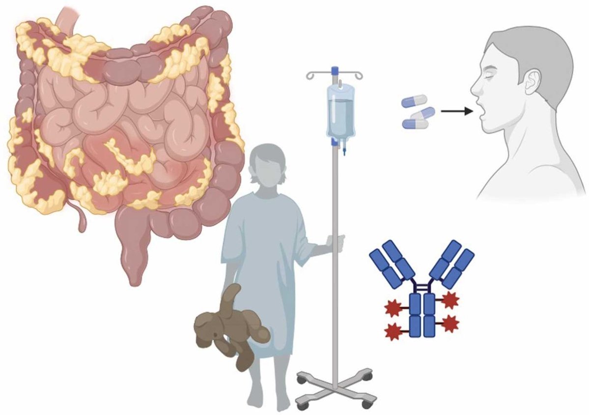 Check out this review on treatments for pediatric inflammatory bowel diseases: authors.elsevier.com/sd/article/S10…
#SmallMoleculeDrugs #CombinationTherapy #InflammatoryBowelDiseases #Pediatry
#openaccess #PharmaTwitter #MedTwitter #research