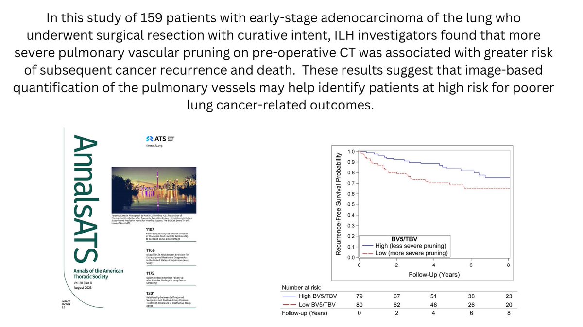 BIDMC Institute for Lung Health tweet media