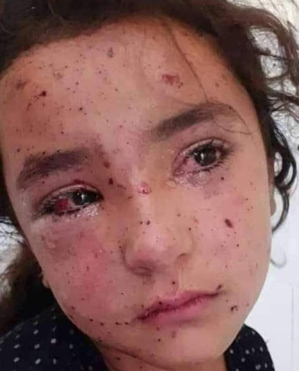 _BurakSezen's tweet photo. "Zalimler için yaşasın cehennem."

#EmpathizeWithGaza
#zionistterror https://t.co/L5rIH5UWXp