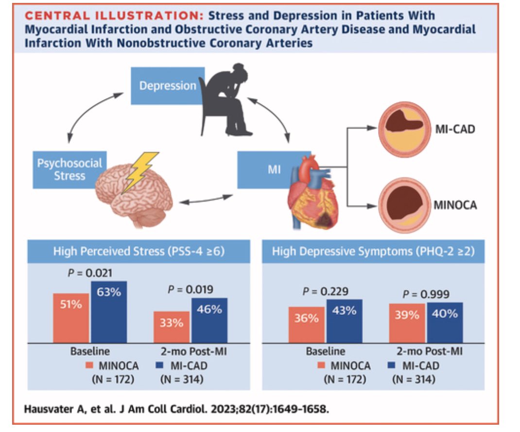 Anais Hausvater (@ahausvater) on Twitter photo Our paper on stress and depression among women with MI. Stress and depression are common among women with MI, stress levels were higher among women with MI-CAD compared to those with MINOCA. <a href="/MArabadjianPhD/">Milla Arabadjian</a> @NSmilowitzMD <a href="/JACCJournals/">JACC Journals</a> jacc.org/doi/10.1016/j.… Our paper on stress and depression among women with MI. Stress and depression are common among women with MI, stress levels were higher among women with MI-CAD compared to those with MINOCA. <a href="/MArabadjianPhD/">Milla Arabadjian</a> @NSmilowitzMD <a href="/JACCJournals/">JACC Journals</a> jacc.org/doi/10.1016/j.…