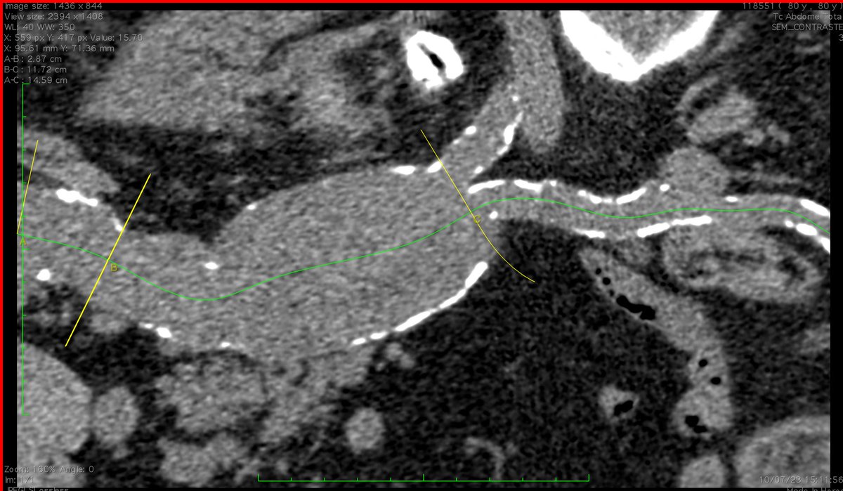 André Poci tweet media