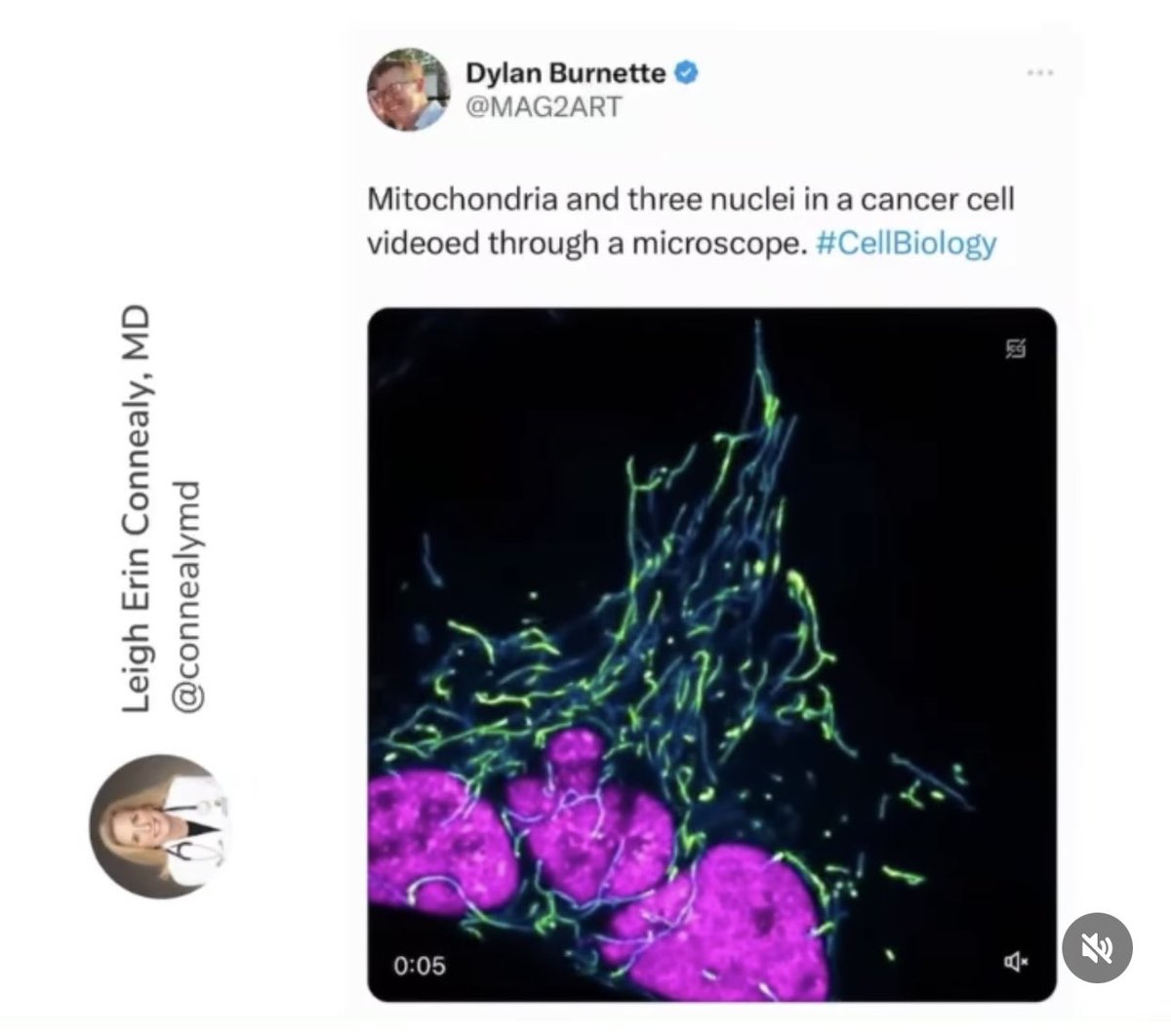 Interesting finds on cancer. #CancerBreakthroughs #ScienceUnveiled #TowardsACure