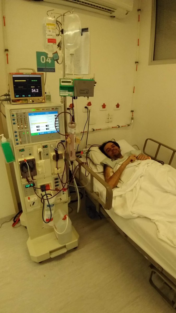 MacSarcastico's tweet photo. Em 2019 eu morri

Nasci em 1980 e nasci com um defeito genético que me acompanhou a vida toda até 2019, durante todo esse tempo eu não soube o que era ter um dia sem dor, tudo o que eu conhecia era dor, por fora, era aparentemente saudável e por mais médicos que eu fosse, nenhum foi capaz de achar o que tinha de errado comigo, as pessoas não acreditavam nessa dor, então, achei que eram normais, desde criança aprendi a engolir a dor e seguir em frente…

Estudei, fiz primeiro e segundo graus, faculdades, mestrado, doutorado, aprendi idiomas, passei a vida estudando e superando obstáculos diários, tudo com muito sacrifício e sacrifício silencioso.

No Natal de 2011, minha mãe veio a falecer depois de 23 anos de batalha contra o câncer, seu coração não suportou mais, esse foi um impacto massivo em mim e em meu pai, e minha saúde se foi por completo, mesmo sem comer direito, comecei a inchar, ganhar peso, minhas pernas incharem e foram mais 8 anos de pioras sucessivas e idas aos médicos em vão. 
 
Até que um dia, acordei muito mal e comecei a vomitar litros de sangue, tive uma parada cardíaca por falta de sangue, o SAMU não veio e um amigo teve que me socorrer de carro.
Meus estômago e esôfago haviam rasgado, e fiquei internado… meu fígado havia virado uma pedra e não passava mais sangue, até que a pressão rasgou meus órgãos em uma agonizante dor, fui operado a primeira vez e fiquei internado na UTI por meses a fio ESPERANDO UM TRANSPLANTE DE FÍGADO, havia perdido a fala, os movimentos e estava vegetativo em uma cama, TOTALMENTE CONSCIENTE E PRESO EM MIM MESMO, as dores que já eram terríveis, ficaram piores.
 
Era um hospital particular e o dinheiro que eu e minha família tínhamos guardado se foi num piscar de olhos, meu pai implorava por uma transferência, mas não deixavam eu ir… ao mesmo tempo (acho que por saber que não poderíamos mais pagar) comecei a ser maltratado e apanhava toda vez que vinham me limpar ou dar banho, certo dia, em junho, fazia 5ºC lá fora, e haviam me deixado sujo de fezes o dia todo na cama, até de madrugada, 3h da manhã, ligaram o ar condicionado frio no quarto, me despiram e me deram um banho gelado, não me secaram e me deixaram nu na cama até às 8h da manhã no dia seguinte, peguei uma pneumonia severa que começou a me sufocar com líquido pulmonar, foi então, com a saturação baixíssima e à beira da morte me amarram na cama e me colocaram uma máscara de oxigênio com pressão positiva, mas numa pressão absurda… AFOGUEI em oxigênio durante 8 dias, sem dormir, só rezando e pedindo forças para Deus, pois não poderia deixar meu pai idoso sozinho… 
 
Com muito custo e briga do meu pai, colocaram um dreno no meu pulmão para a remoção do líquido, fiquei 3 meses com esse dreno tirando mais de 4 litros desse líquido por dia, um Médico teve dó de mim, vi em seu olhar, não consigo me lembrar seu nome, mas pude ler sua expressão, conseguiu que fosse transferido para o Hospital de Transplantes do SUS, operado pelo Albert Einstein e comecei a ser tratado como gente novamente, minhas preces haviam sido ouvidas pela primeira vez, lá tratado com carinho e respeito fui recobrando os movimentos e um pouco da fala, contudo, não podia beber água e nem me alimentar, foram 70 dias sem comer e 45 dias sem sequer molharem minha boca, meus órgãos estavam entrando em falência múltipla, meus rins pararam, me ligaram em máquinas, meu intestino, minha tireoide e meu coração já batia cada dia mais fraco… minha língua de tão seca, começou a cair pedaços minúsculos e eu a engoli-los. 
 
Então no dia 12 de junho os médicos conversaram perto do meu leito bem baixo: Está morrendo, se não chegar um fígado em até 72h… não sei não… 
Foi a primeira vez que chorei quieto no meu canto, olhei para cima e comecei a falar com Deus, justificar o porquê de que precisava ficar, comecei a rezar novamente, por 68h eu rezei sem parar, eu rezei pedindo para ficar, para ficar com meu pai. 
às 2h da manhã do dia 15, me acordaram e disseram… chegou um órgão compatível, você vai falar com o médico… 
Ele chegou e disse: você ainda está com pneumonia, está super fraco, mas vamos operar, você consente? Suas chances são de 1%. 
Eu acenei, sim com a cabeça e fomos… durante a cirurgia eu morri por 4 minutos (que para mim foram horas em outro lugar, mas isso é para uma outra vez), fui reanimado e correu tudo bem no pós operatório de 13h de transplante…
Foram mais meses de internação, fazendo todo tipo de terapia, hemodiálise, demorou 3 anos para que eu voltasse a andar direito, tive que reaprender a engolir, a falar, a me mexer de novo… 
 
E estou hoje aqui, não sou digno de pena e dó, eu sobrevivi o impossível, pois meu Deus é o Deus do impossível… venci uma falência múltipla de órgãos e tudo isso descrito aí em cima. 
Não vim sensibilizar as pessoas para ganhar inscritos, vim ser a prova viva do que o impossível é possível. 
Eu vim fazer amigos e lutar por um Brasil melhor, mesmo sendo um insignificante no meio do mundo, que ainda sente dores diárias, treme, e tenta buscar a paz.
 
Eu estou aqui por vocês, não por mim.
Deus abençoe a todos... 
Um grande abraço do Márcio... Mac Dinossauro 🦖