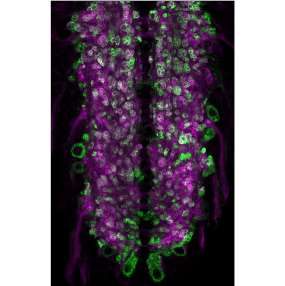 The Vollum Institute is accepting applications for multiple faculty openings. We are interested in individuals whose research focuses on molecular and cellular neuroscience, genetics, neurodevelopment or signal transduction. #sciencejobs #neurotwitter 
academicjobsonline.org/ajo/jobs/25404