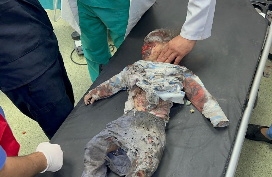 “Bir zulme engel olamıyorsanız onu herkese duyurun!”