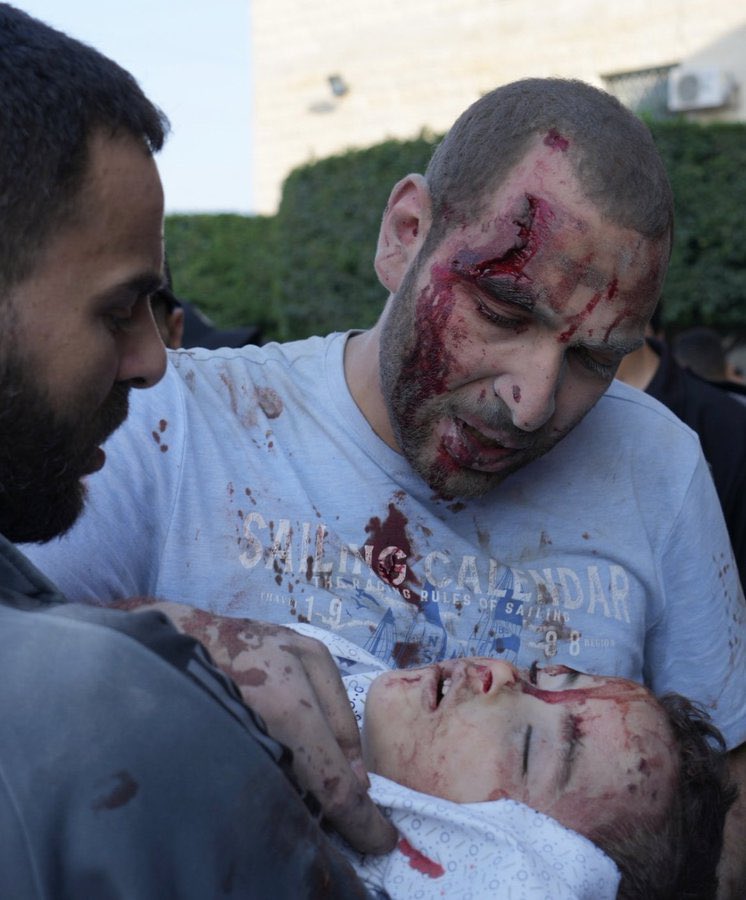 Heart-wrenching: Palestinian father, oblivious to his own wounds, tends to his son’s lifeless body slaughtered by Israeli occupation missiles. 

#GazaGenocide #gazaunderattack