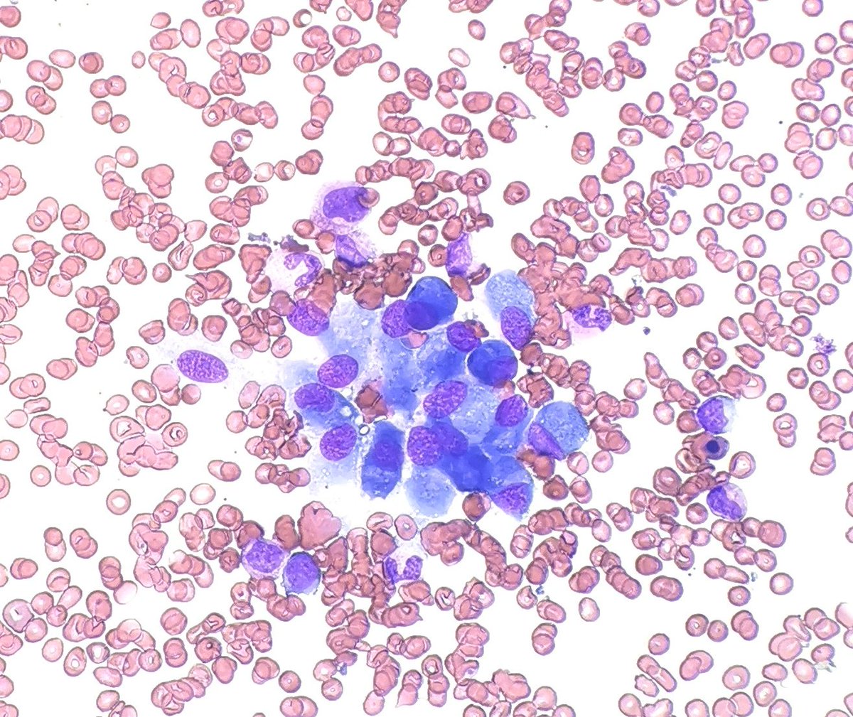 Waht do you want to call these cells on a BM aspirate?