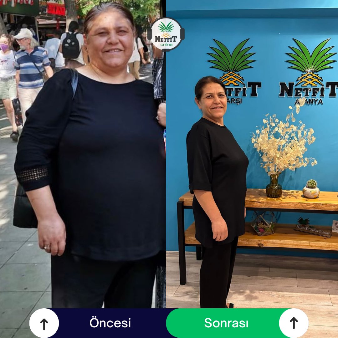 netfitonline's tweet photo. Sevgili danışanımızla beraber online diyet sürecimizde tam tamına -40 kiloyu geride bıraktık.💪🏻🍍
Sağlığına bizimle beraber en ‘net’ adımı atan danışanımızı NetFit Online ekibi olarak tebrik ediyoruz. 💙👏🏻
#NetFit #OnlineDiyet https://t.co/zfG9iN9rs3