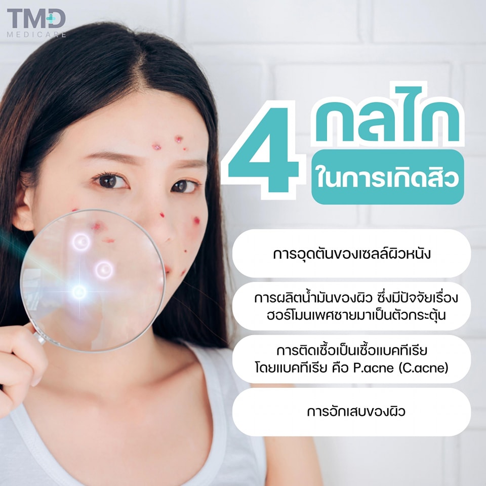 TMDMedicare's tweet photo. ทำไมรักษาสิวเองแล้วไม่ประสบความสำเร็จ !!!
อาจเป็นเพร��ะเรายังดูแลไม่ได้ครอบคลุมทุกสาเหตุของการเกิดสิวน

#สิว #รักษาสิว #TMD #TMDMedicare #Exosome #Growthfactor #exne #tamadaclinic #สิวหาย
#เปบไทด์ https://t.co/TnfSZDDMCh