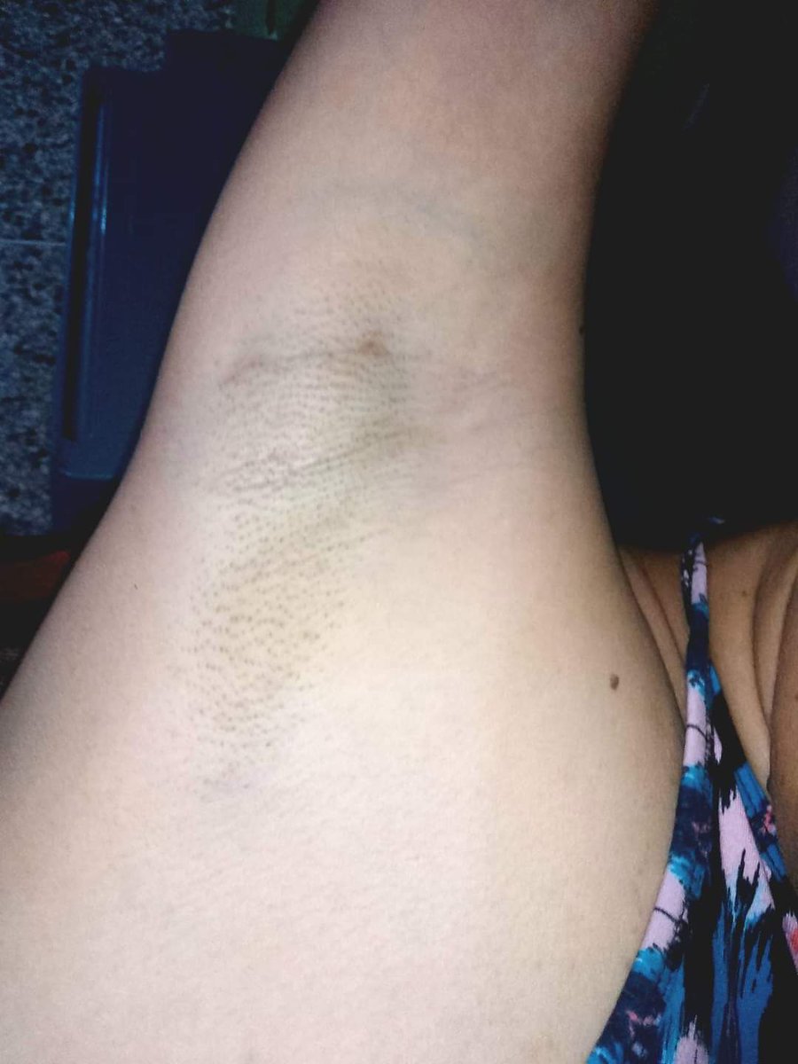 love the armpit (@dragonpinkspink) on Twitter photo 
